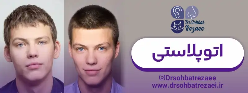 اتوپلاستی چیست؟