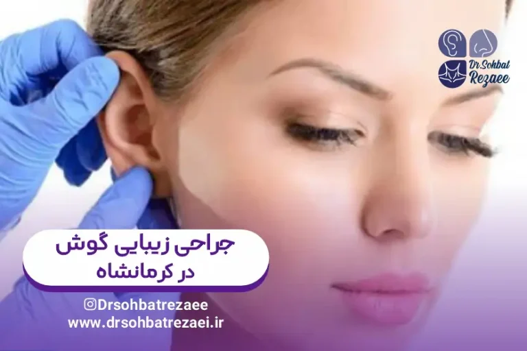 عمل زیبایی گوش در کرمانشاه