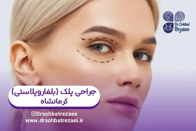 جراحی بلفاروپلاستی کرمانشاه