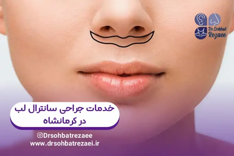 خدمات جراحی سانترال لب کرمانشاه