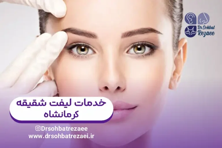 بهترین دکتر لیفت شقیقه در کرمانشاه
