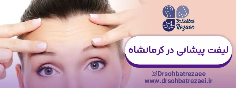 لیفت پیشانی در کرمانشاه
