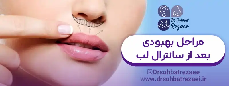 مراحل بهبودی بعد از سانترال لب