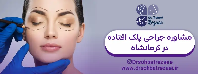 مشاوره جراحی پلک افتاده در کرمانشاه