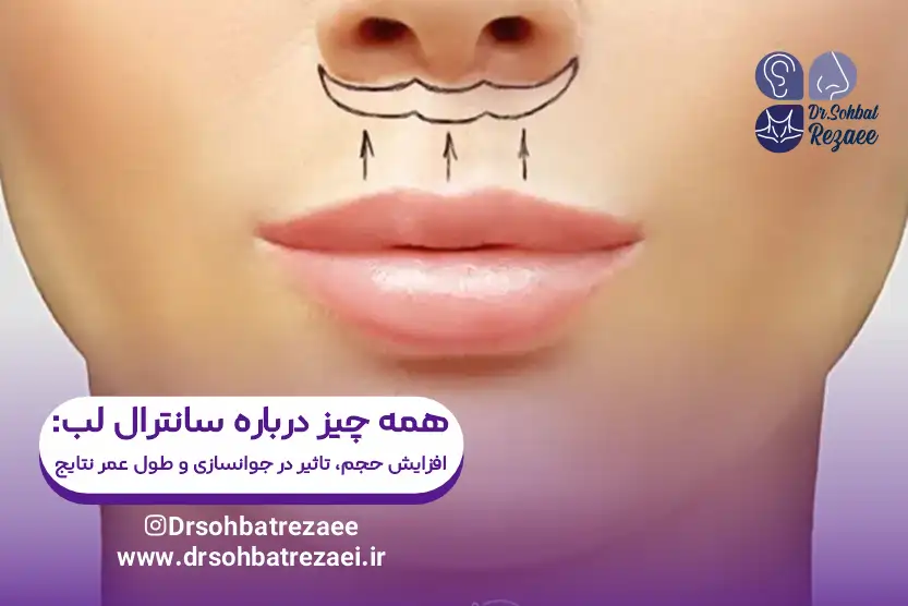 همه چیز درباره جراحی سانترال لب
