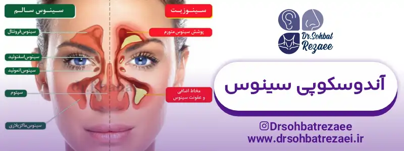 آندوسکوپی سینوس در کرمانشاه