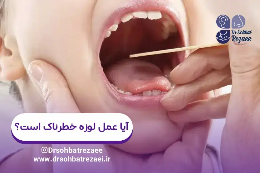 آیا عمل لوزه خطرناک است؟