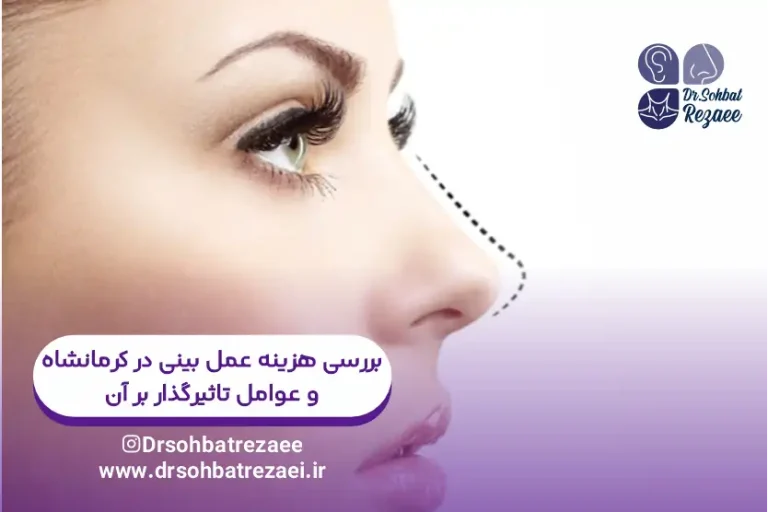 بررسی هزینه عمل بینی در کرمانشاه
