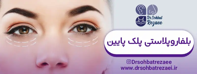 بلفاروپلاستی پلک پایین