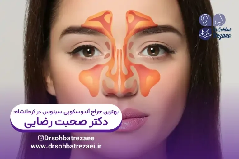 بهترین جراح آندوسکوپی سینوس در کرمانشاه