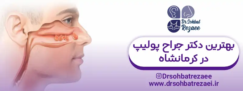 دکتر جراح پولیپ بینی در کرمانشاه
