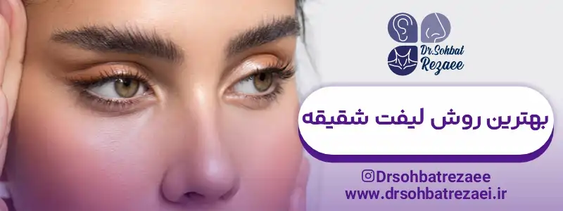 بهترین روش لیفت شقیقه