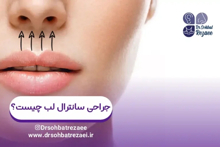 جراحی سانترال لب چیست