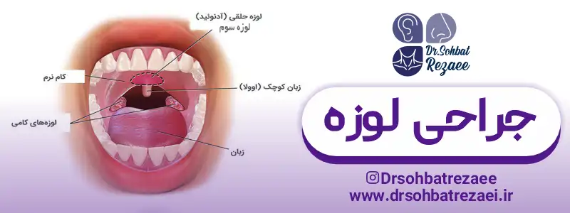 خطرات جراحی لوزه در کودکان