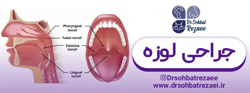 خطرات جراحی لوزه