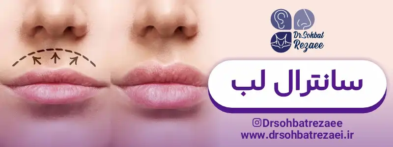 عمل سانترال لب
