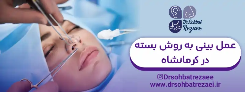 عمل بینی به روش بسته در کرمانشاه