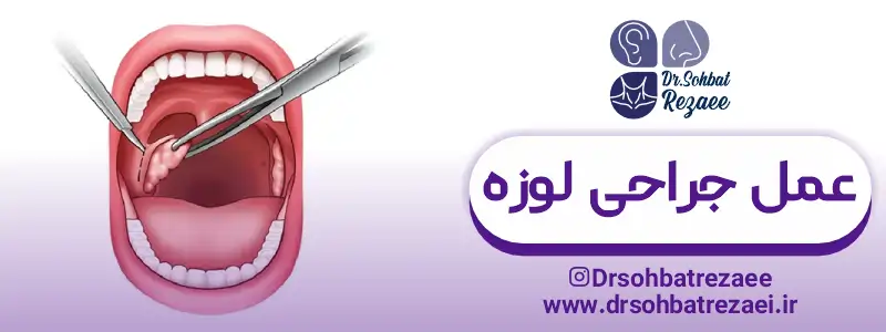 کاهش خطرات جراحی لوزه
