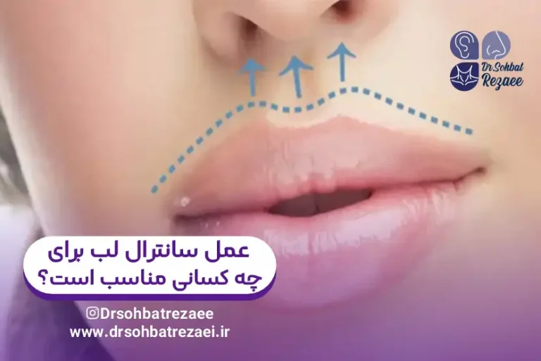 عمل سانترال لب برای چه کسانی مناسب است؟