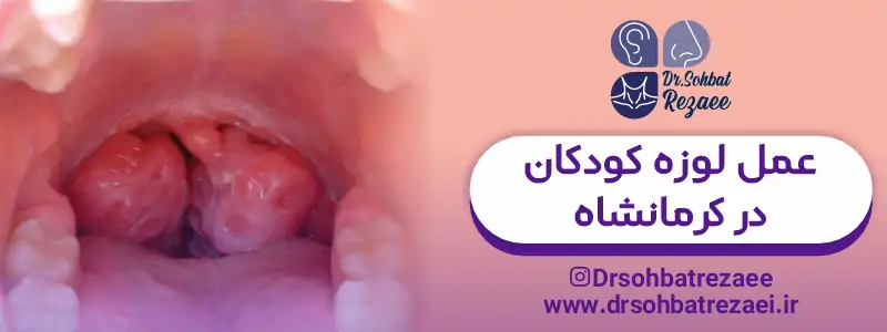 بهترین جراح لوزه کودکان در کرمانشاه