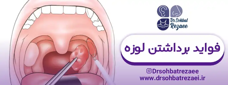 فواید برداشتن لوزه