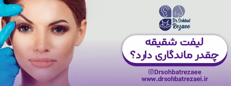 لیفت شقیقه چقدر ماندگاری دارد