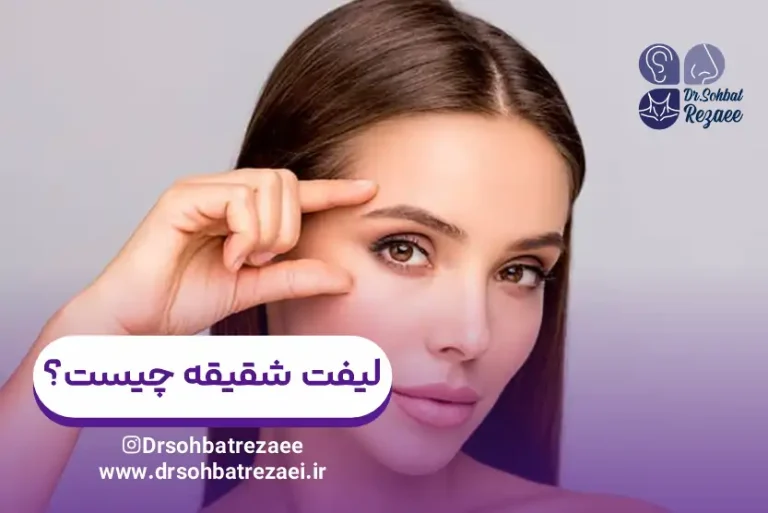 لیفت شقیقه چیست؟