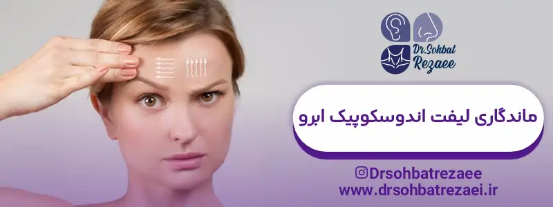ماندگاری لیفت اندوسکوپیک ابرو