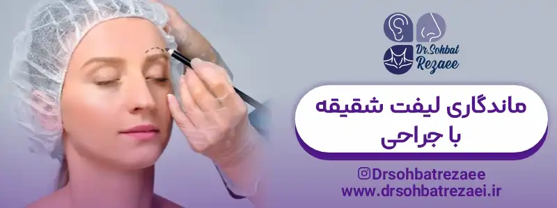 ماندگاری لیفت شقیقه با جراحی