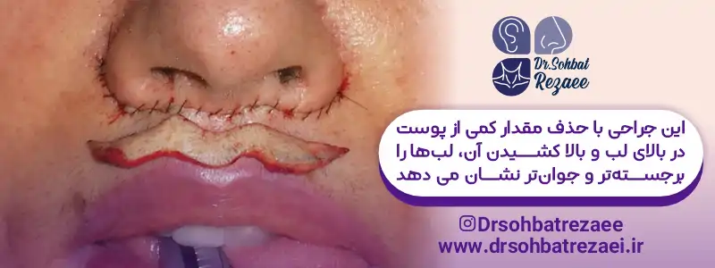 محل برش سانترال لب