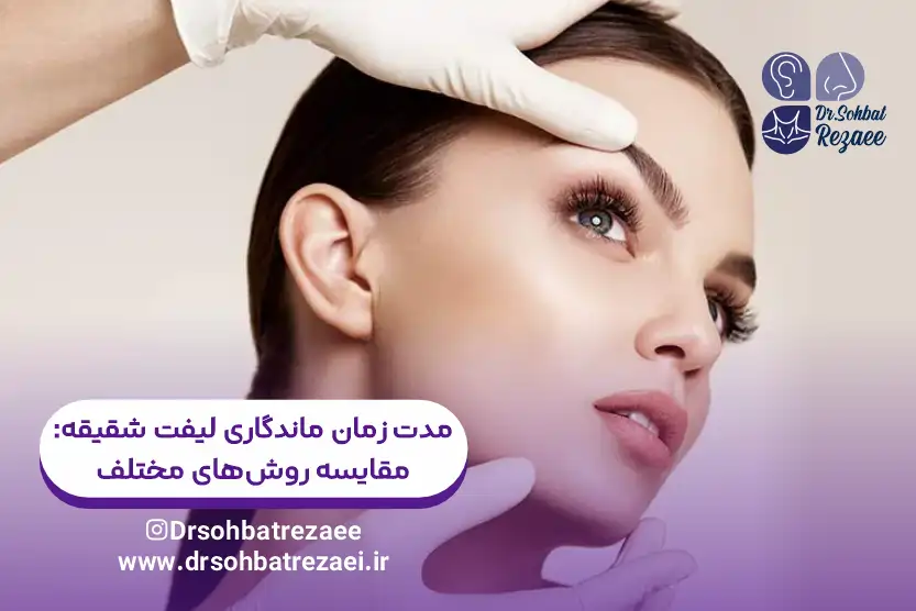 مدت زمان ماندگاری لیفت شقیقه