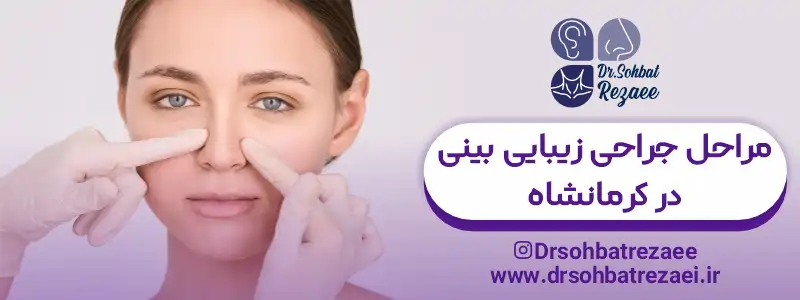 مراحل جراحی زیبایی بینی در کرمانشاه