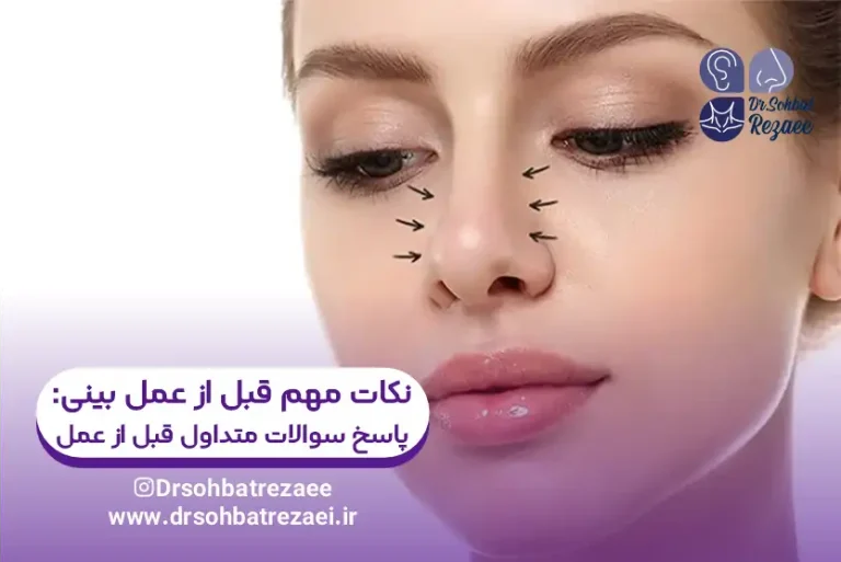 نکات مهم قبل از عمل بینی