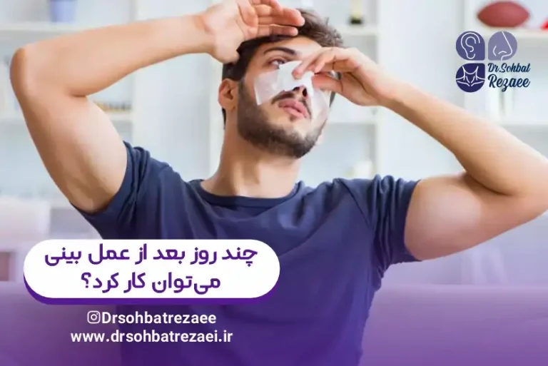 چند روز بعد از عمل بینی میتوان کار کرد؟