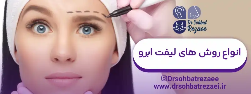 انواع روش های لیفت ابرو