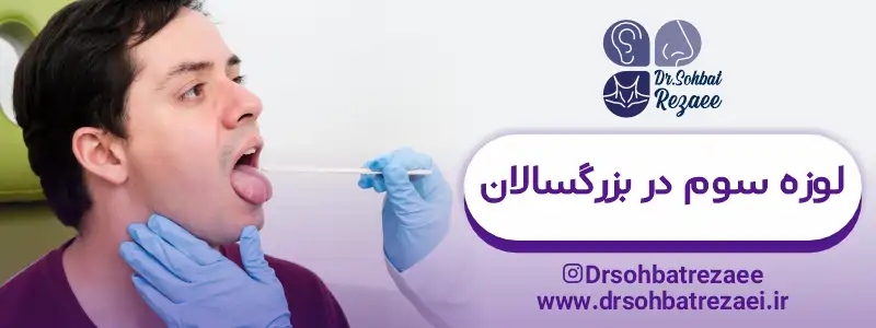 لوزه سوم در بزرگسالان
