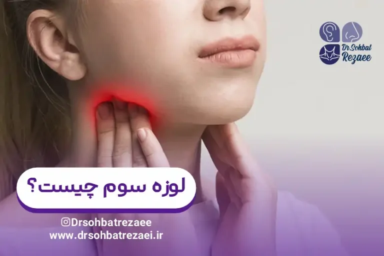 لوزه سوم چیست