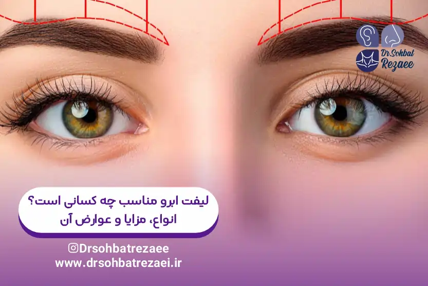 لیفت ابرو مناسب چه کسانی است؟