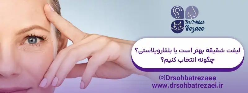 لیفت شقیقه بهتر است یا بلفاروپلاستی؟ چگونه انتخاب کنیم؟
