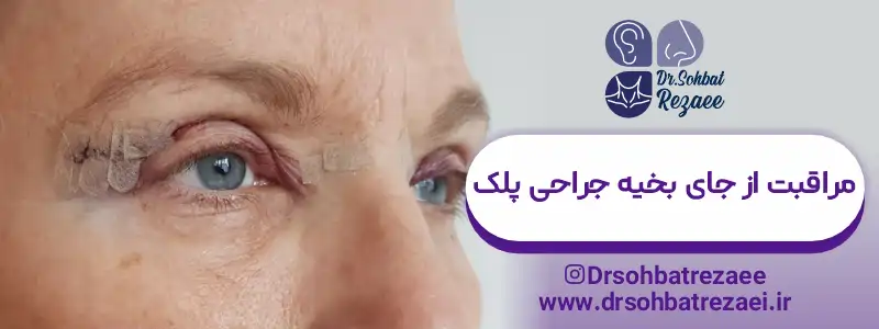 مراقبت از جای بخیه جراحی پلک