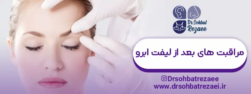 مراقبت های بعد از لیفت ابرو
