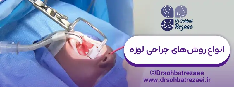 انواع روش های جراحی لوزه