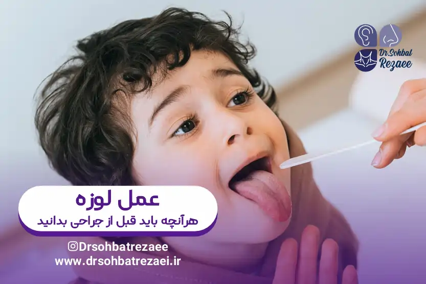 عمل لوزه چیست؟ و هرآنچه باید درمورد جراحی لوزه بدانید