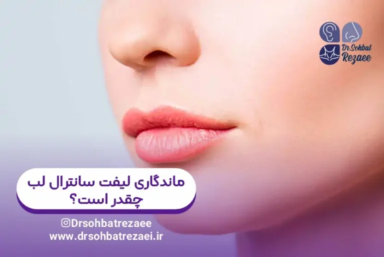 ماندگاری لیفت سانترال لب چقدر است