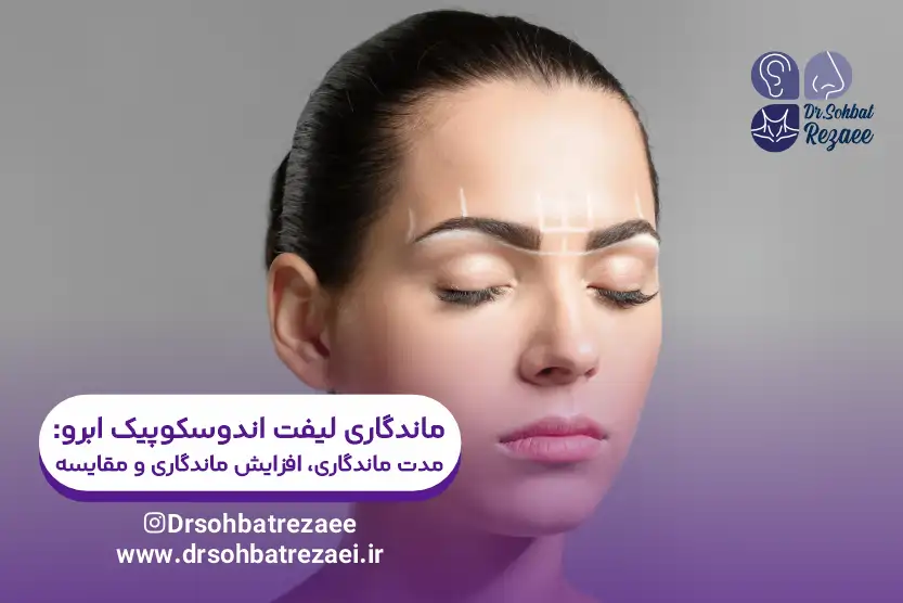 ماندگاری لیفت اندوسکوپیک ابرو