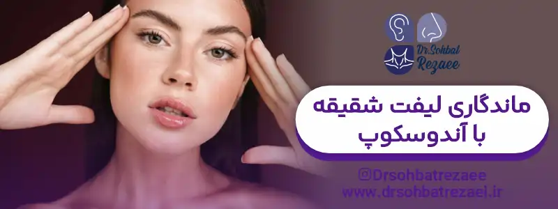 ماندگاری لیفت شقیقه با آندوسکوپ