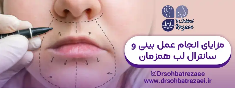 مزایای انجام عمل بینی و سانترال لب همزمان