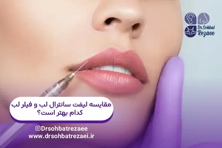 لیفت سانترال لب یا فیلر لب. کدام بهتر است؟