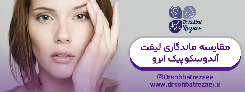 مقایسه ماندگاری لیفت اندوسکوپیک ابرو