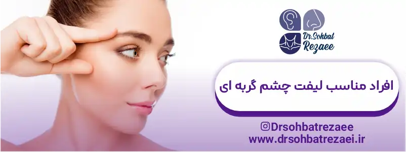 افراد مناسب لیفت چشم گربه ای